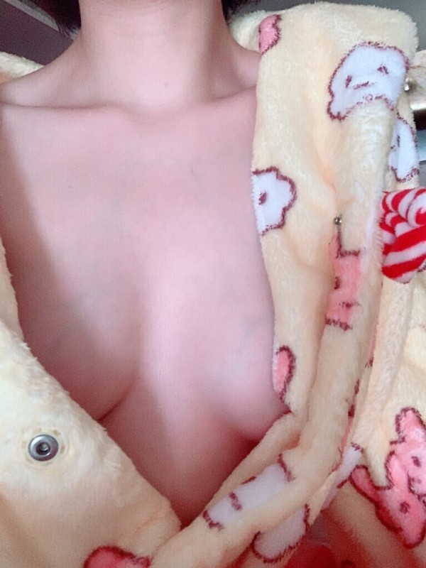 실핏줄